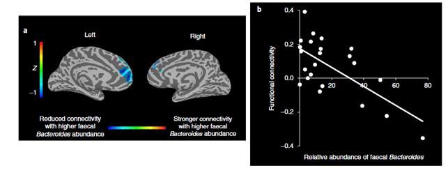 우울증 환자의 뇌 구조 fMRI 분석과 Bacteroides 장내 미생물의 풍부함과의 연관성 분석.